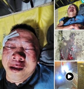 Hải Phòng-Nhóm Thanh Niên Đánh Cả Viên Công An