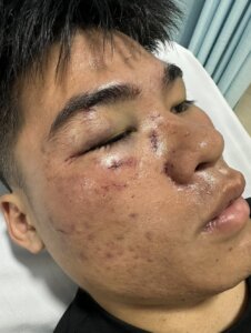 Cô Gái Gọi Người Yêu Mới Đánh Người Yêu Cũ